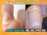 KBS 아침이 좋다…