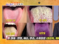 KBS 아침이 좋다…