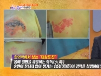 KBS 아침이 좋다…