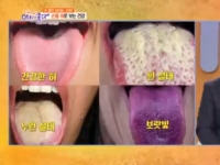 KBS 아침이 좋다…