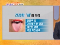 KBS 아침이 좋다…