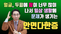 안면다한증