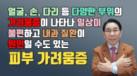 피부 가려움